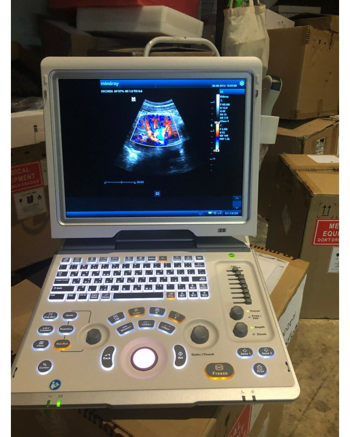 Mindray Z5 Portable Ultrasound Ultrasound