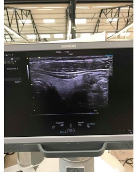 Siemens Acuson S2000 HELX Evolution Ultrasound Machine Ultrasound