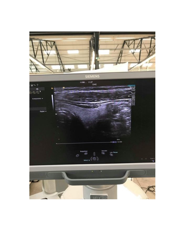 Siemens Acuson S2000 HELX Evolution Ultrasound Machine Ultrasound