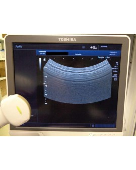 Toshiba Aplio 300 Ultrasound Ultrasound