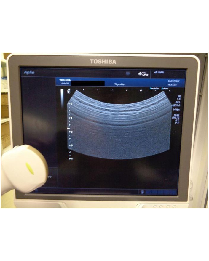 Toshiba Aplio 300 Ultrasound Ultrasound