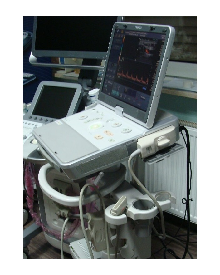 Toshiba Viamo SSA-640A Ultrasound Ultrasound