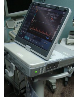 Toshiba Viamo SSA-640A Ultrasound Ultrasound