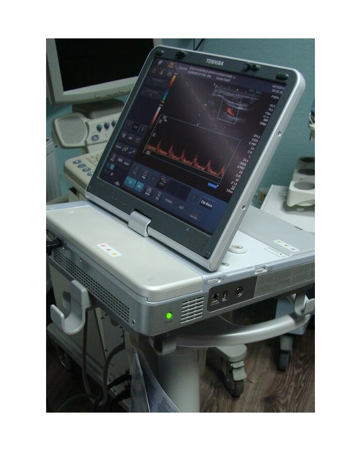 Toshiba Viamo SSA-640A Ultrasound Ultrasound