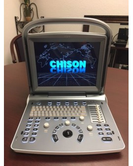 Chison ECO 6 Portable Ultrasound System New Ultrasound
