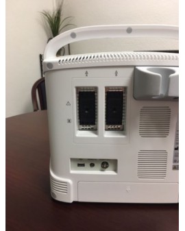 Chison ECO 6 Portable Ultrasound System New Ultrasound