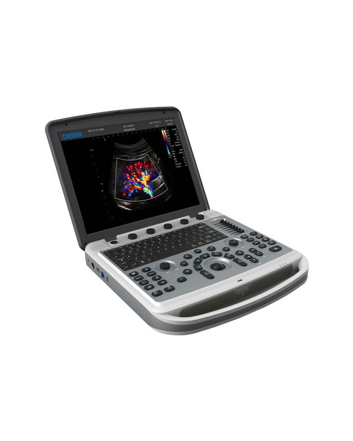 Chison Sonobook 9 Vet Portable Ultrasound New Ultrasound