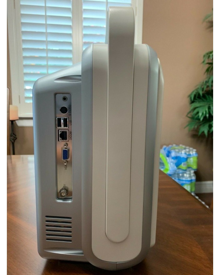 Chison Q9 Portable Ultrasound System Ultrasound