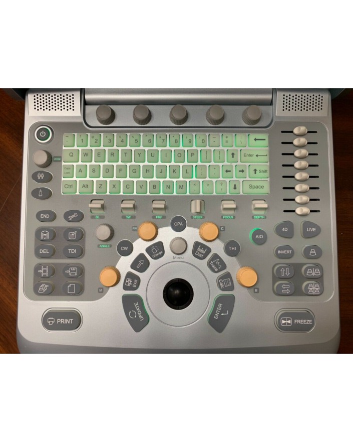 Chison Q9 Portable Ultrasound System Ultrasound