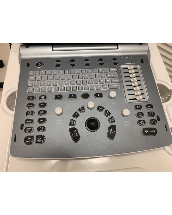 Chison Q5 Portable Ultrasound System Ultrasound