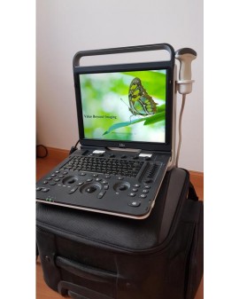 Chison EBit 60 Portable Ultrasound with Probes Ultrasound