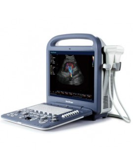 SonoScape S2 Portable Ultrasound System Ultrasound