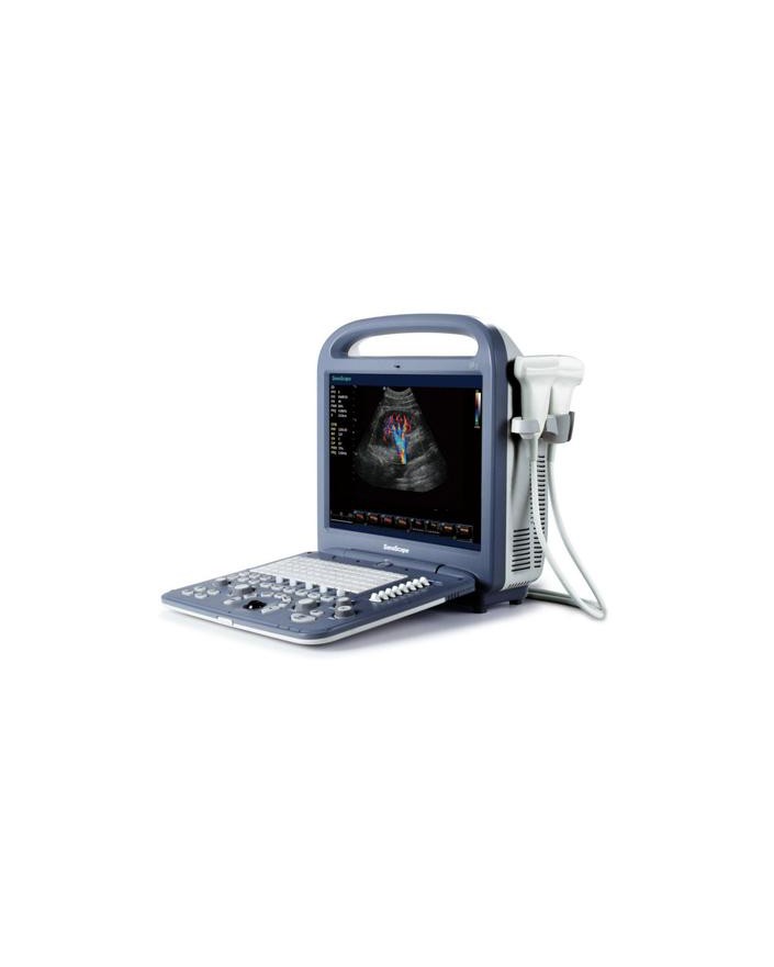 SonoScape S2 Portable Ultrasound System Ultrasound