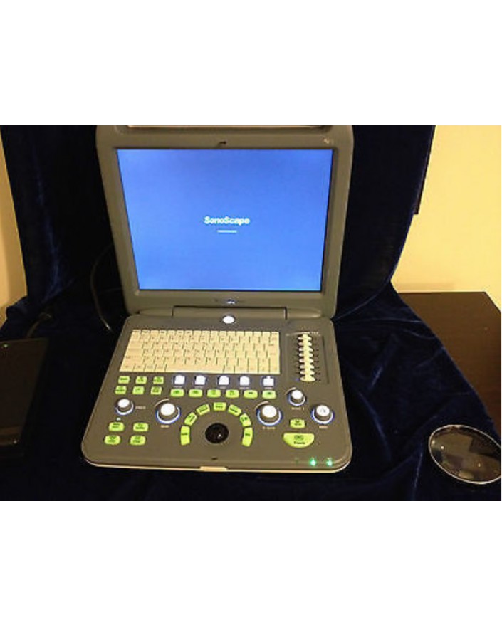 SonoScape S2 Portable Ultrasound System Ultrasound