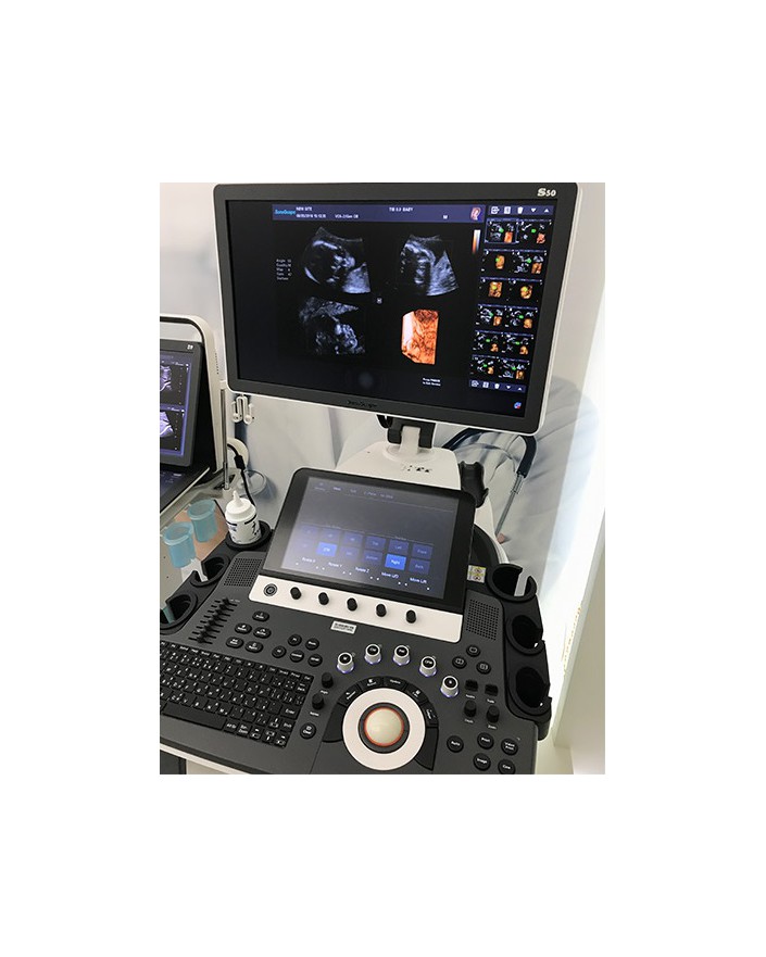 Sonoscape S50 Trolley Color Doppler System OB / GYN Ultrasound New ...