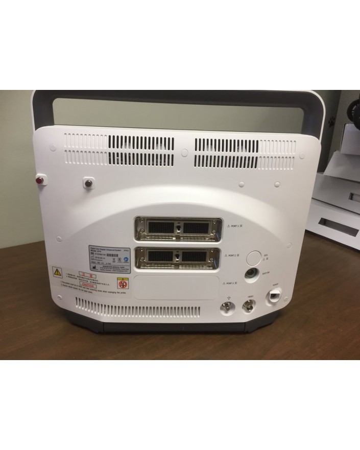 Sonoscape E1 Portable Ultrasound System Ultrasound