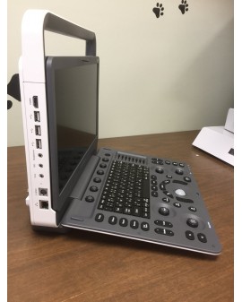 Sonoscape E1 Portable Ultrasound System Ultrasound