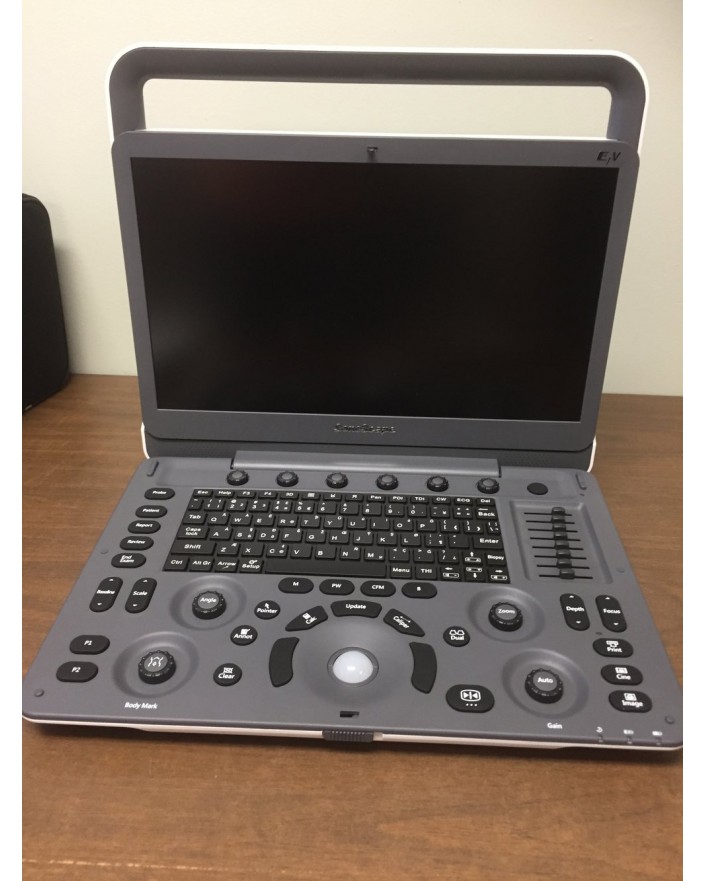 Sonoscape E1 Portable Ultrasound System Ultrasound