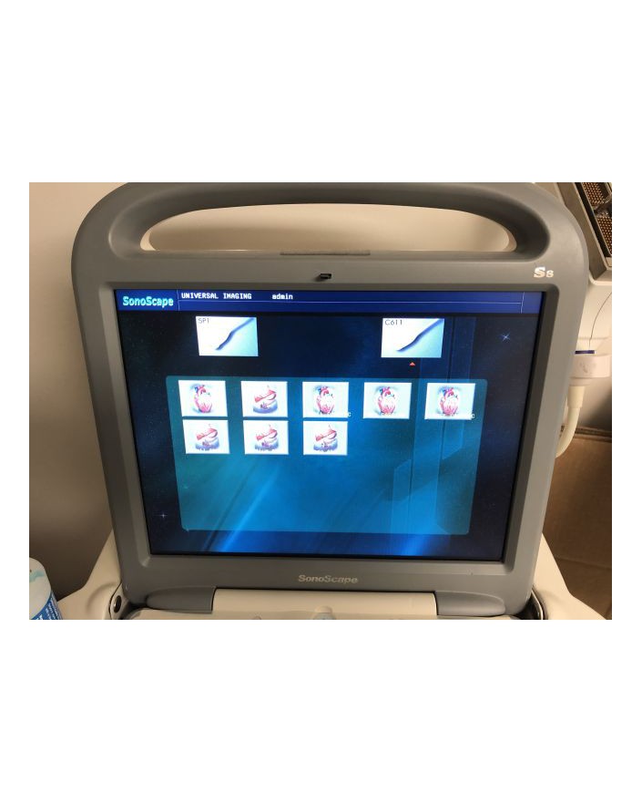 SonoScape S8 Shared Service Ultrasound Ultrasound