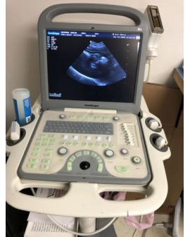 SonoScape S8 Shared Service Ultrasound Ultrasound