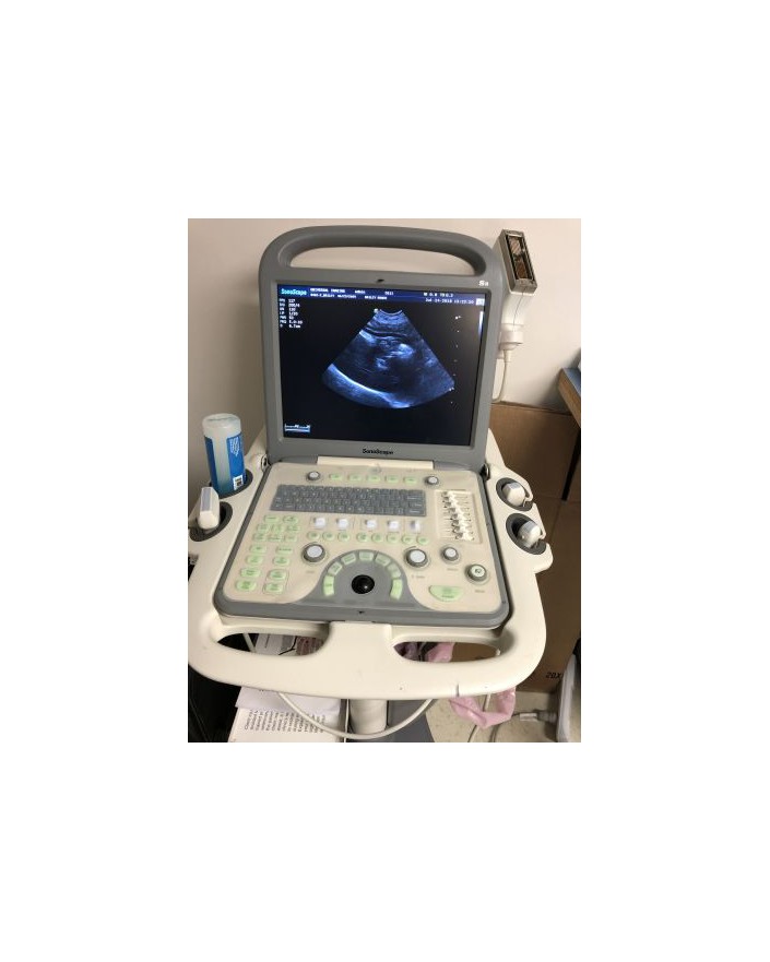 SonoScape S8 Shared Service Ultrasound Ultrasound