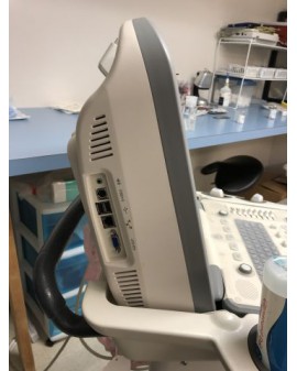 SonoScape S8 Shared Service Ultrasound Ultrasound
