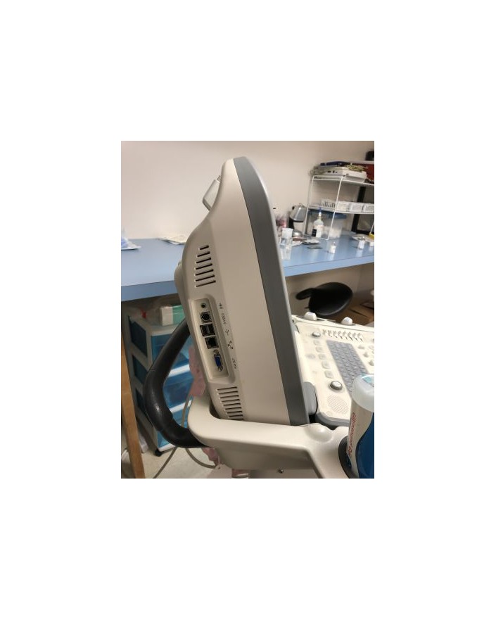 SonoScape S8 Shared Service Ultrasound Ultrasound