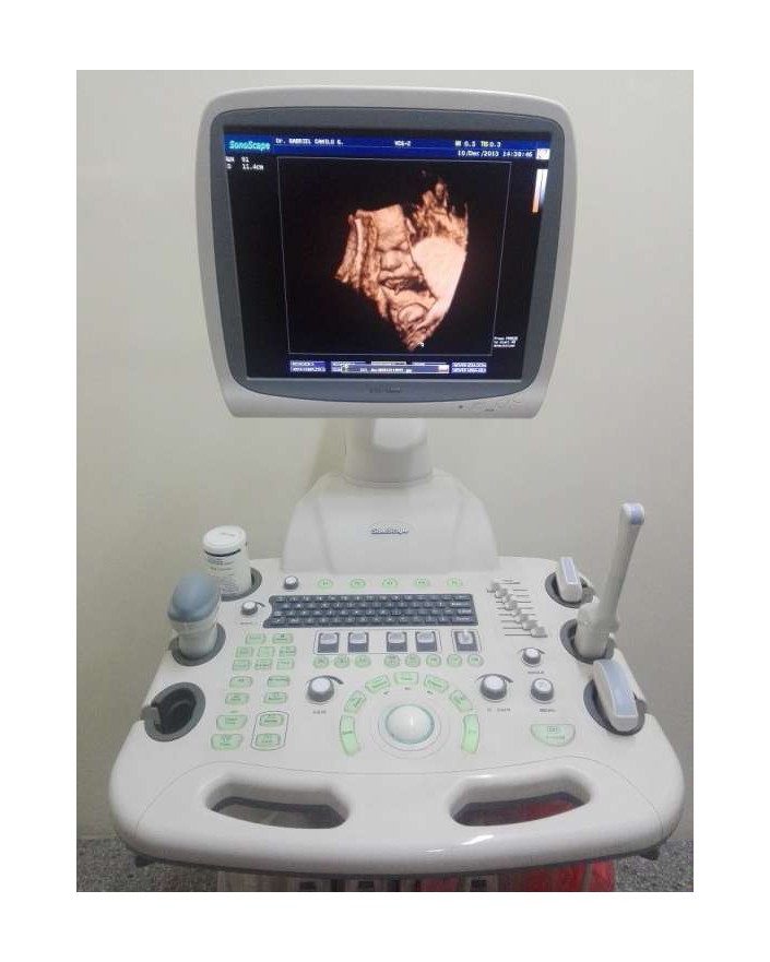 Sonoscape SSI-8000 Ultrasound Machine Ultrasound