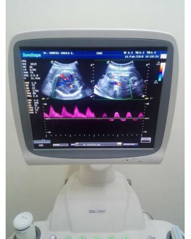 Sonoscape SSI-8000 Ultrasound Machine Ultrasound