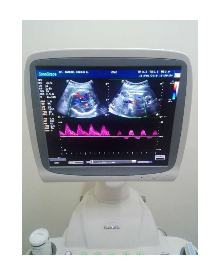 Sonoscape SSI-8000 Ultrasound Machine Ultrasound