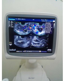 Sonoscape SSI-8000 Ultrasound Machine Ultrasound