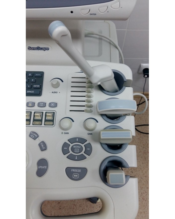 Sonoscape SSI-6000 Ultrasound Machine Ultrasound