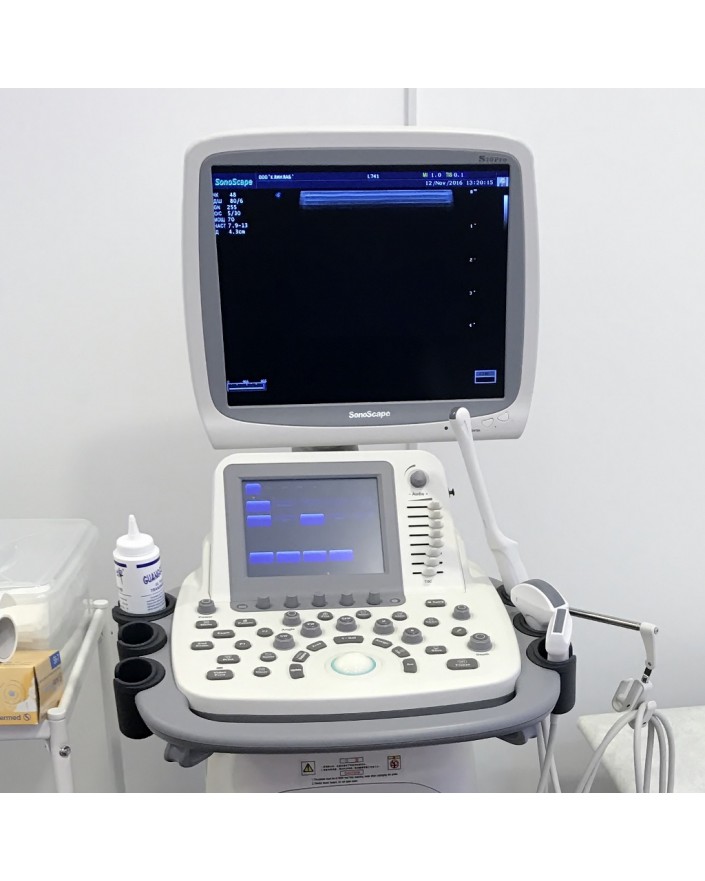 Sonoscape S20 Trolley Color Doppler Ultrasound Ultrasound