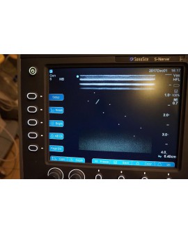 SonoSite S-Nerve Ultrasound System Ultrasound