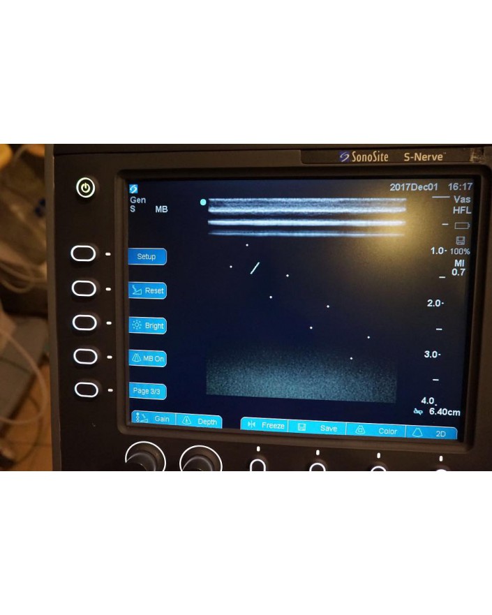 SonoSite S-Nerve Ultrasound System Ultrasound