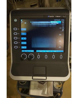 SonoSite S-Nerve Ultrasound System Ultrasound
