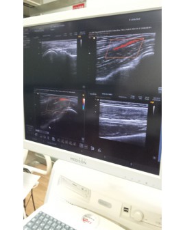 Samsung Accuvix V10 Ultrasound Machine Ultrasound