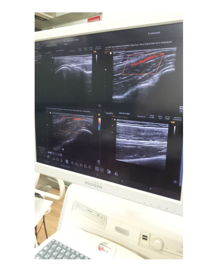 Samsung Accuvix V10 Ultrasound Machine Ultrasound