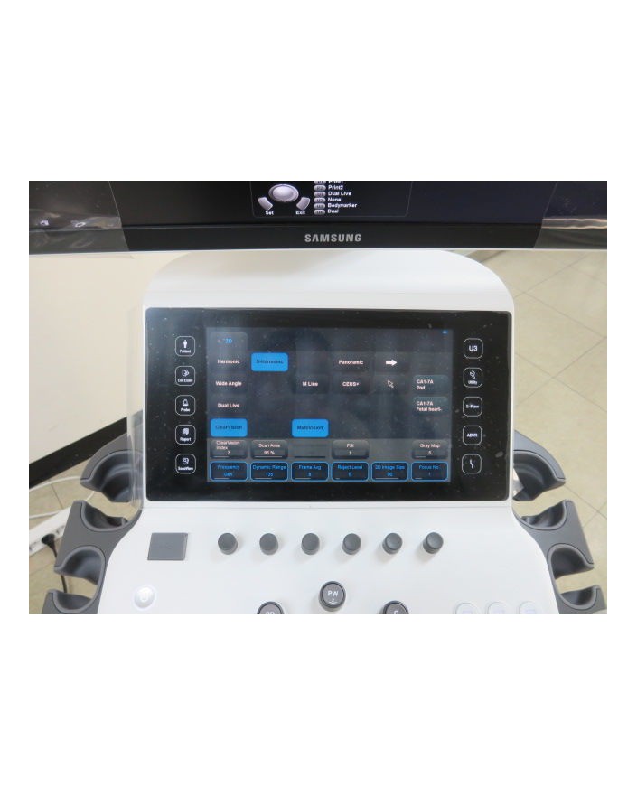 Samsung UGEO WS80A Elite Ultrasound Machine Ultrasound