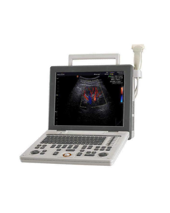 Samsung Sonovet R3 Ultrasound New Ultrasound