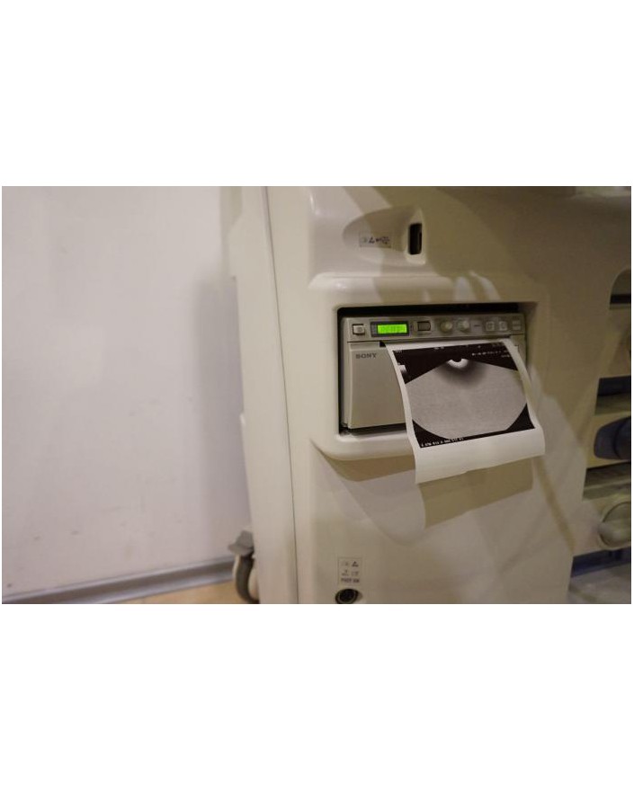 Aloka Prosound Alpha 7 Ultrasound Machine Ultrasound