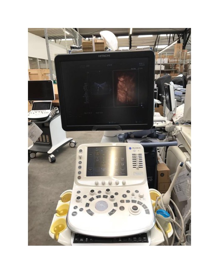 Hitachi Aloka Arietta V70 OB-GYN Ultrasound Ultrasound