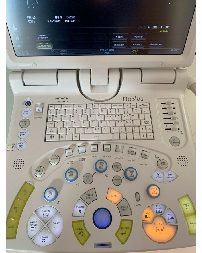 Hitachi Aloka Noblus Ultrasound Machine Ultrasound