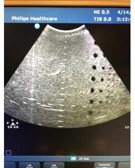 Philips CX30 Ultrasound System with Transducer Ultrasound