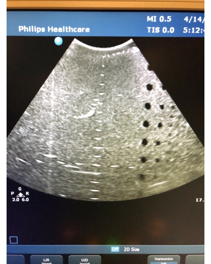 Philips CX30 Ultrasound System with Transducer Ultrasound